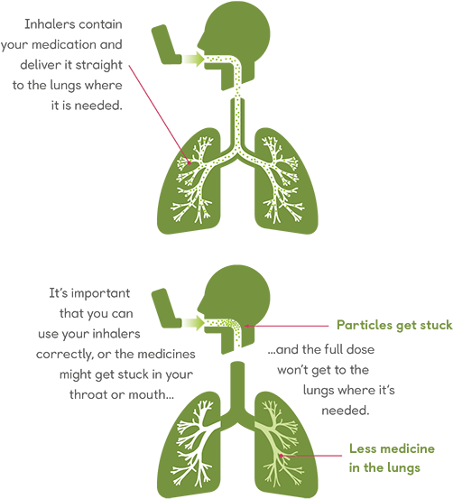 About Inhalers - Patient (570x570), Png Download