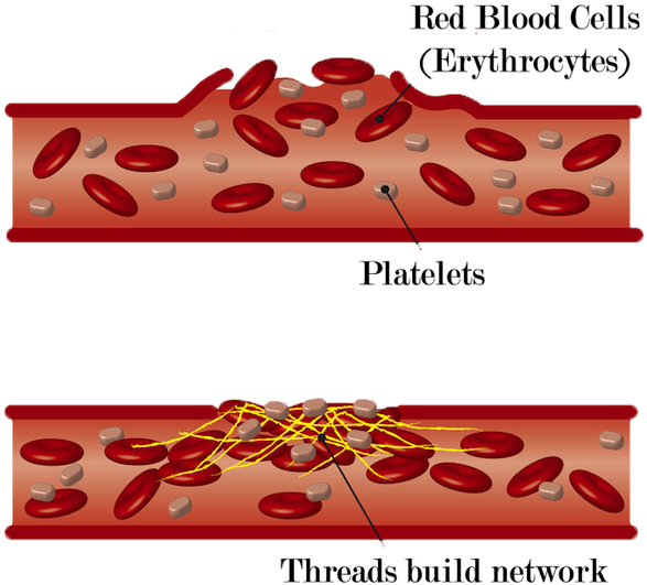Blood Clot Formation - Damage Of Blood Vessels (600x581), Png Download
