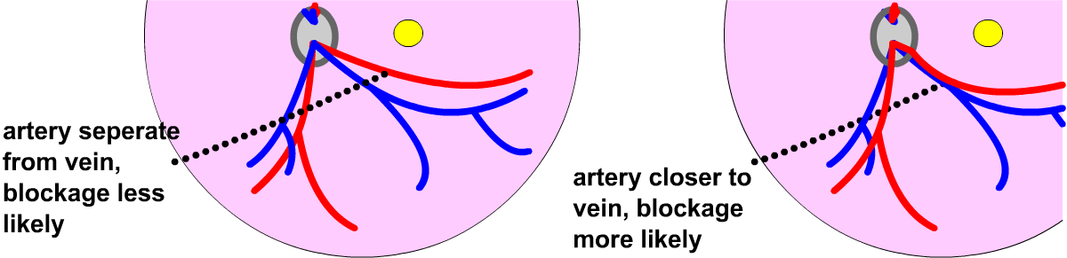 Eye - Artery (1200x291), Png Download