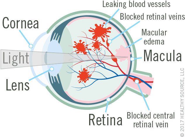 Diagram Of Eye Shows Cornea, Lens, Macula And Retina, - Diagram (640x497), Png Download