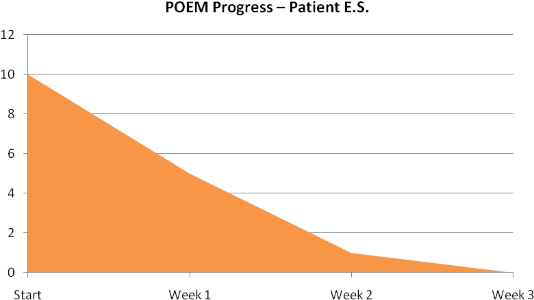 Poem Es (828x490), Png Download