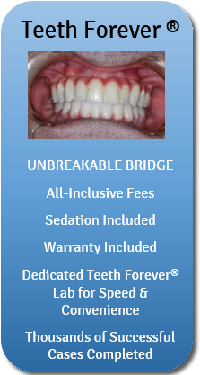 Teeth Dental Implants - Dental Implant (300x420), Png Download