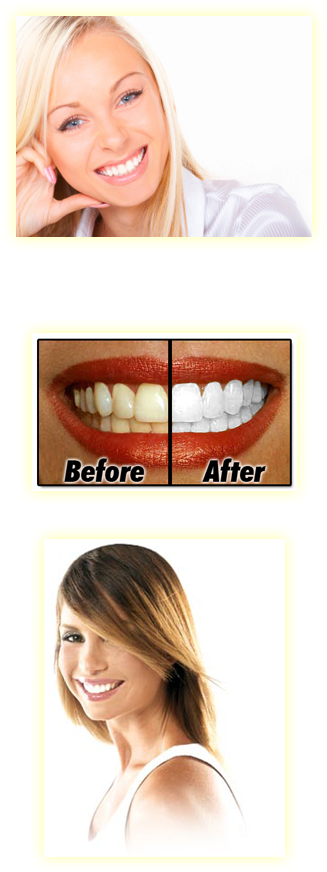 Teeth Whitening Is Perhaps The Most Common Cosmetic - Isme Rasyan Herbal Clove Toothpaste Natural Whitening (371x954), Png Download