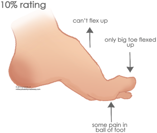 The Foot 6 - Toe Flex (504x427), Png Download