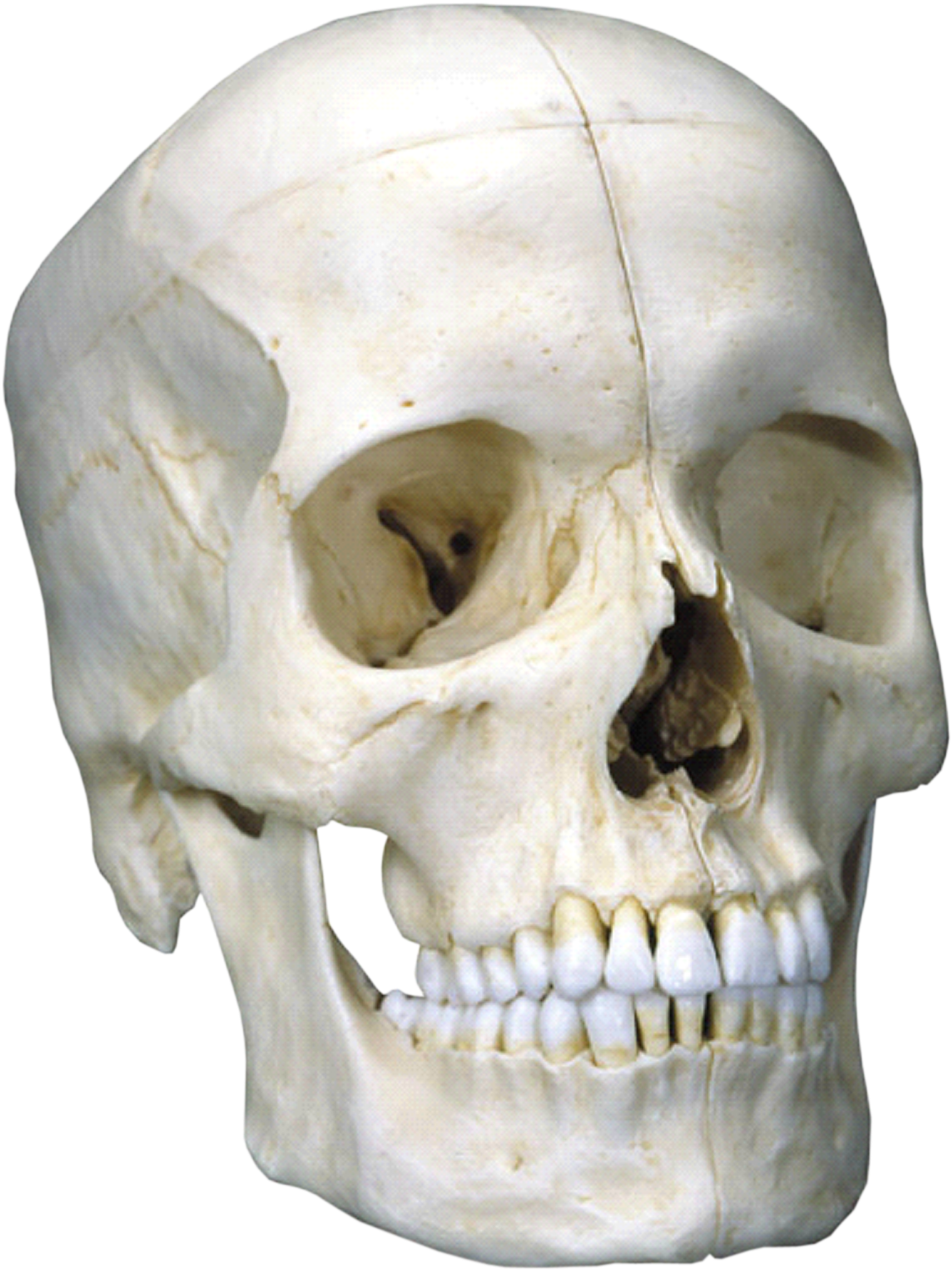Crane - 3b Scientific Bonelike Skull Bony Skull 6 Part (1601x1794), Png Download