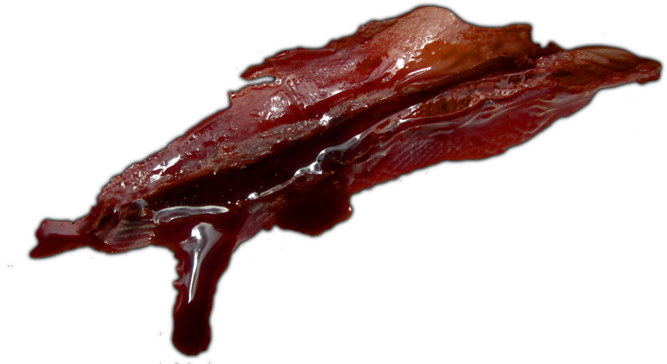 Scar Png - Blood Wound Png (1024x553), Png Download