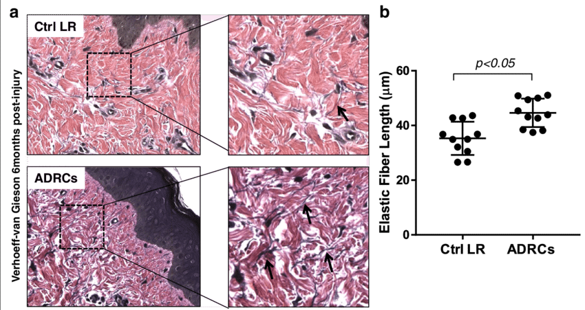 Effect Of Adrcs On Elastic Fiber Length - Flower (850x451), Png Download