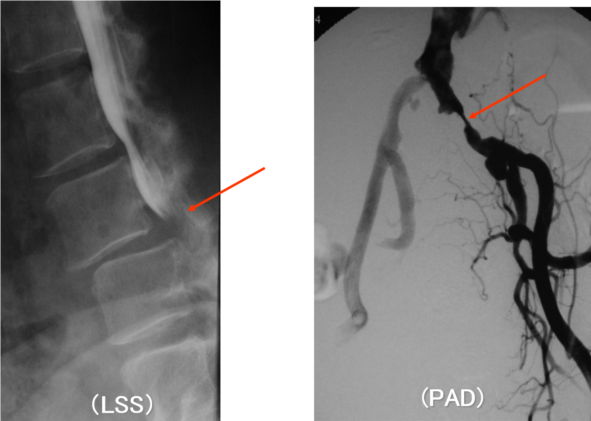 Identification Of The Causative Disease Through Walking - Leg (1366x878), Png Download