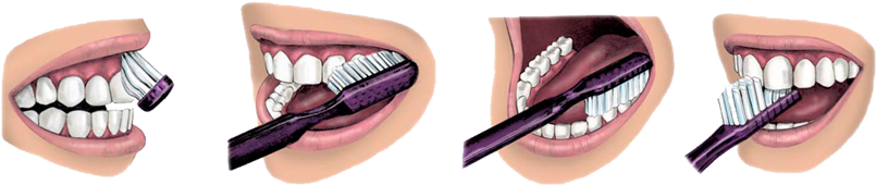 How To Brush Your Teeth - Modified Stillman S Technique (848x211), Png Download