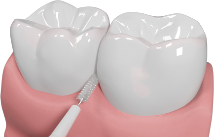 Interdentalbrush-work - Interdental Brush Png (434x277), Png Download