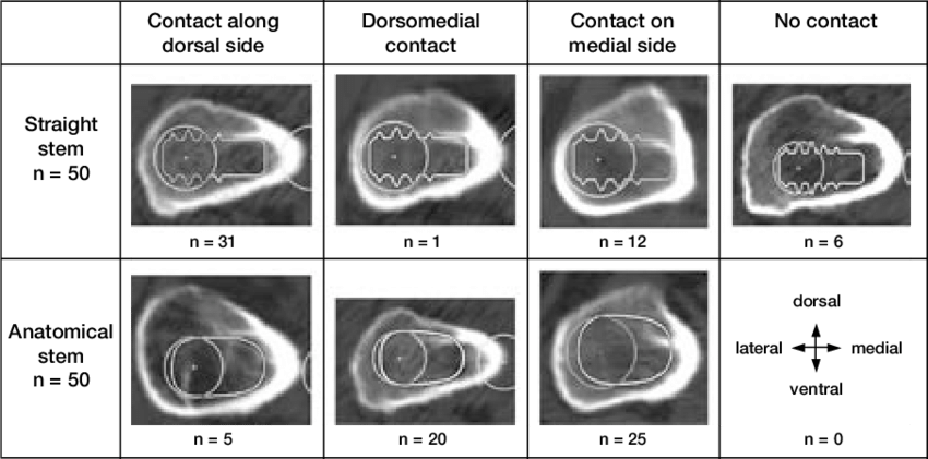Location Of Contact Between The Internal Calcar Septum - Nasal Septum (850x421), Png Download