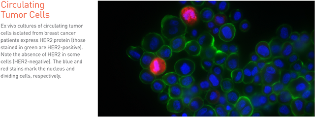 Yet, The Appearance Of Her2-positive Breast Cancer - Circulating Tumor Cell Her2 (650x245), Png Download