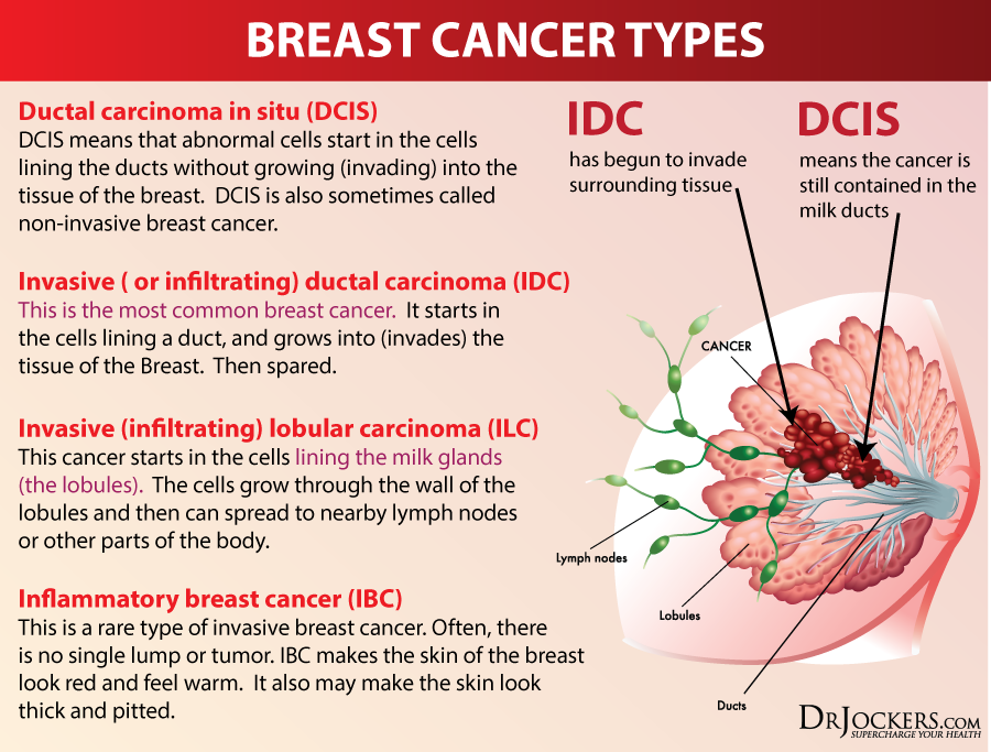 On The Other Hand, 20 To 30% Of Breast Cancer Cancers - Types Of Breast Cancer (900x683), Png Download