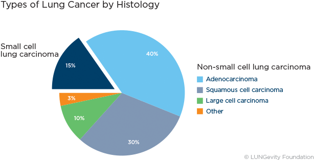 Types Of Lung Cancer - Common Is Lung Cancer (638x335), Png Download
