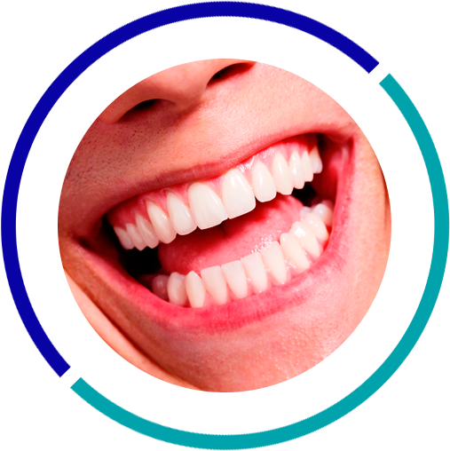 Oral Rehabilitation - White Teeth Smile With Dental Mirror (507x508), Png Download