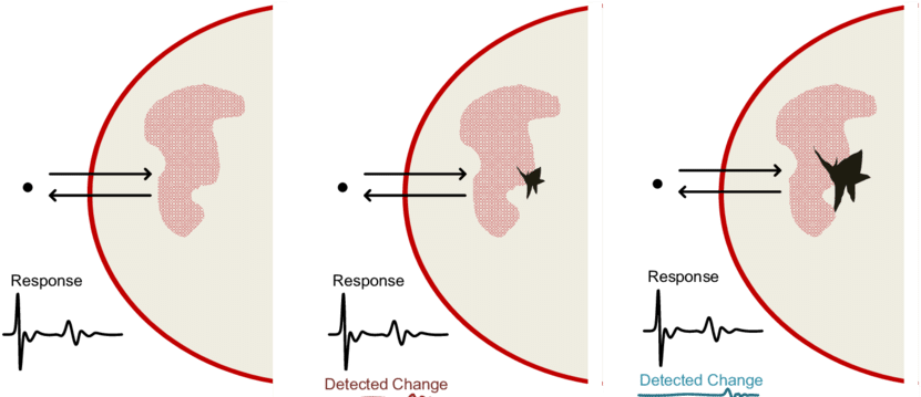 Llustration Of Three Breasts At Different Stages Which - Circle (850x382), Png Download