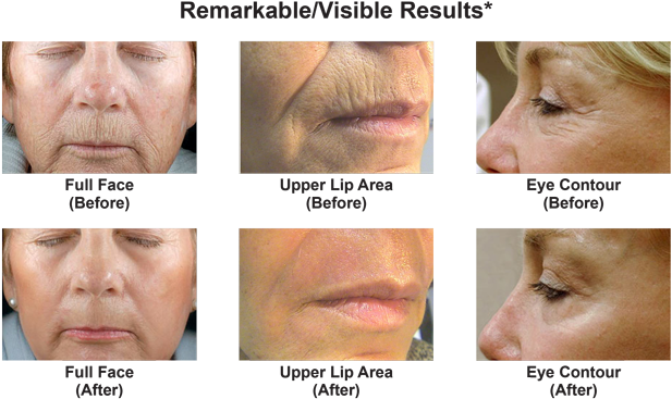 What Can Dot Co2 Therapy Do For Me - Collage (675x377), Png Download