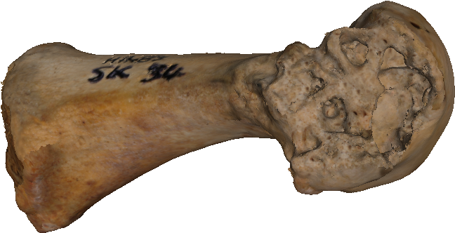 1st Metatarsal With Lesions Caused By Gout - Tool (1920x927), Png Download