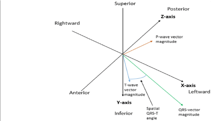 Example Of Determining The P Wave Vector Magnitude - Diagram (850x392), Png Download
