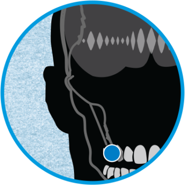 Molar Mic (375x376), Png Download