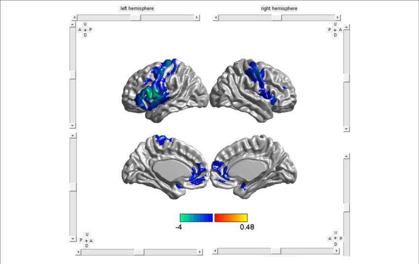 0 Software Was Used To Visualize The Anatomical Distribution - .org (850x537), Png Download