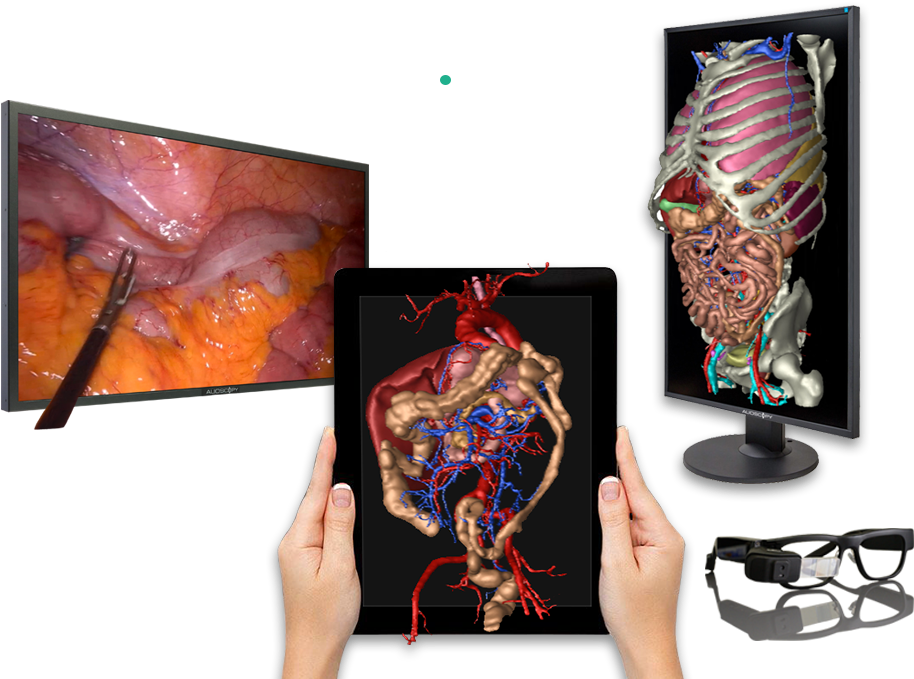3d Technology Applied To Surgery - Surgery (1070x708), Png Download