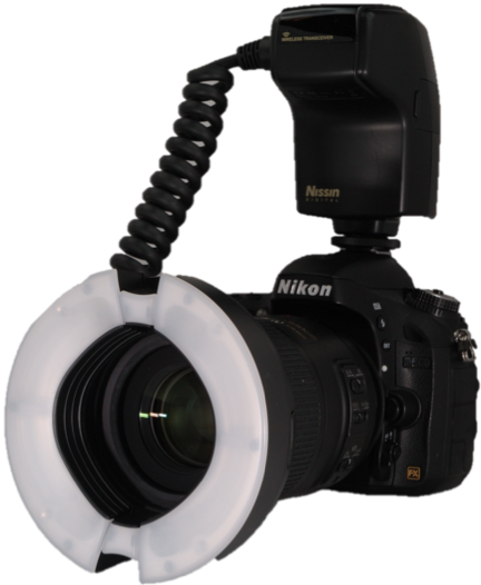 Digital Photography In Dentistry - Dental Photography Camera (432x526), Png Download