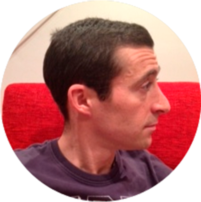 Anthony Anthony Father Of A Girl With Arthritis - Child (700x675), Png Download