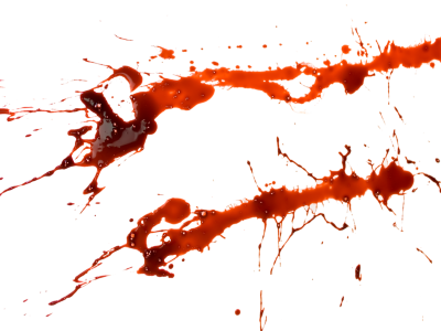 Blood Png Splashes - Blood Splatter Png Transparent Background (400x300), Png Download