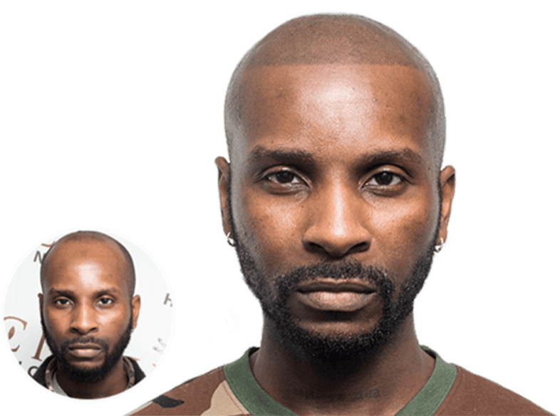 When I Looked In The Mirror After My Msp I Was So Amazed - Vinci Hair Clinic (800x600), Png Download