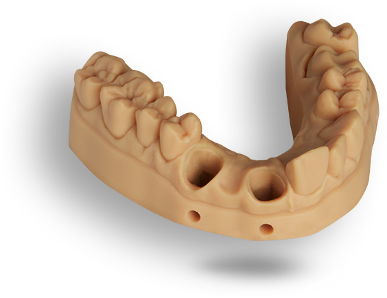 3d Printing Is The Catalyst For Digital Dentistry - Dental Models 3d Printed (564x435), Png Download