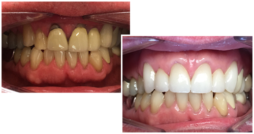 Here At 3d Dental Laboratories We Offer Only The Highest - Tongue (500x264), Png Download