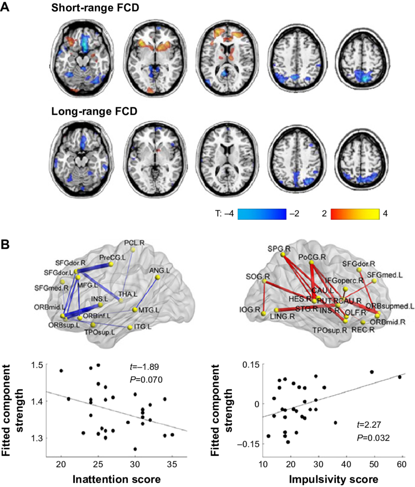 Disturbed Connectivity In Adhd - Notes Disturbed (850x998), Png Download