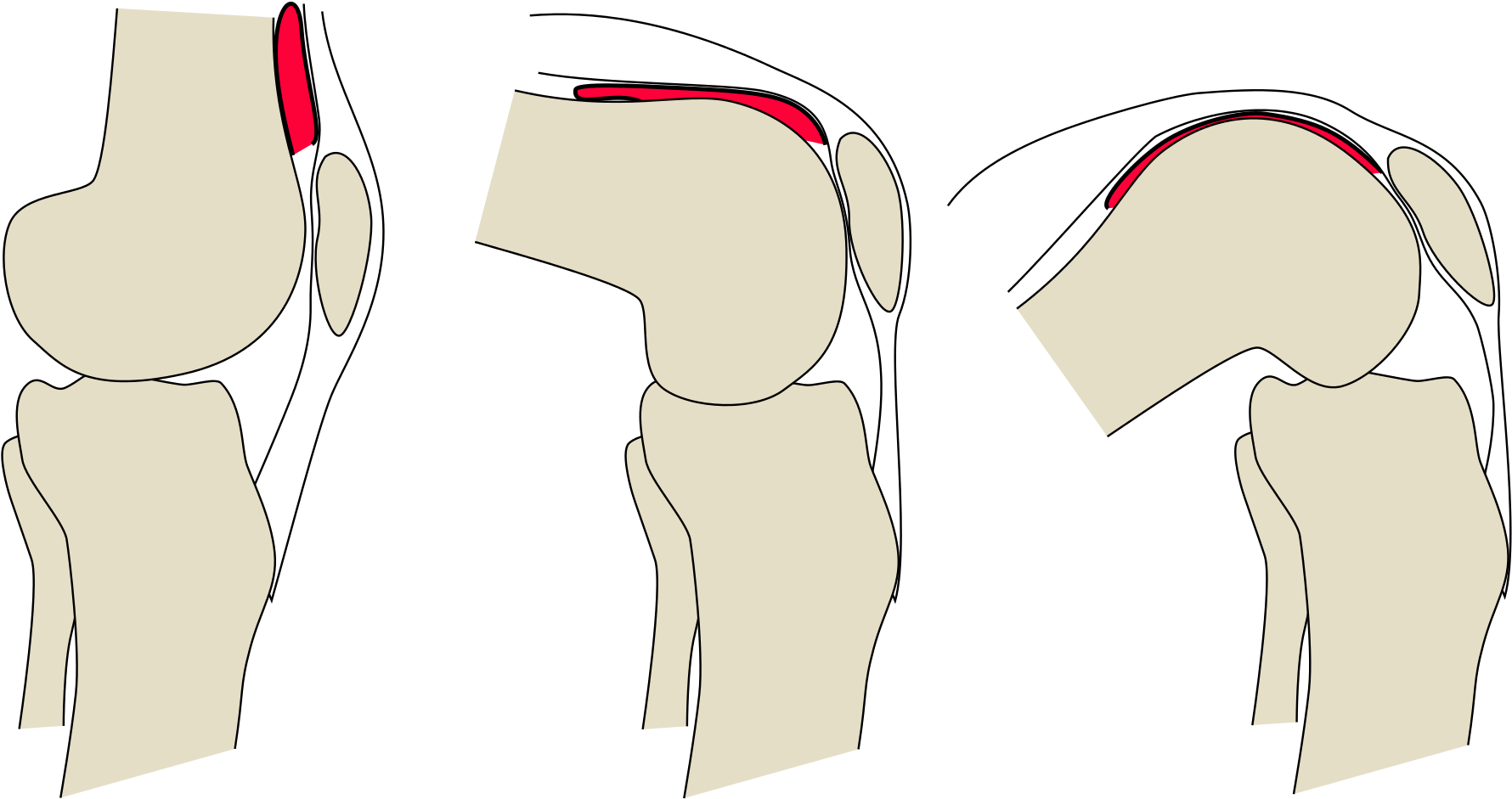 Open - Articularis Genu Muscle Knee (2000x1156), Png Download