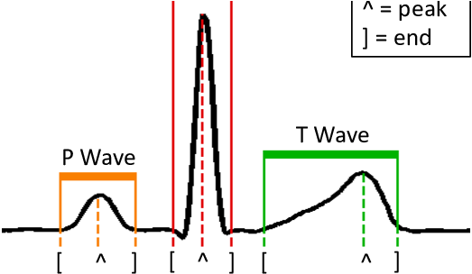 Delineated Normal Heartbeat [25] - Methadone (668x303), Png Download