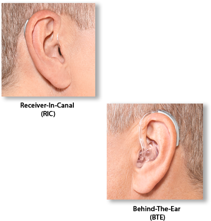Of Hearing Loss - Diagram (500x469), Png Download