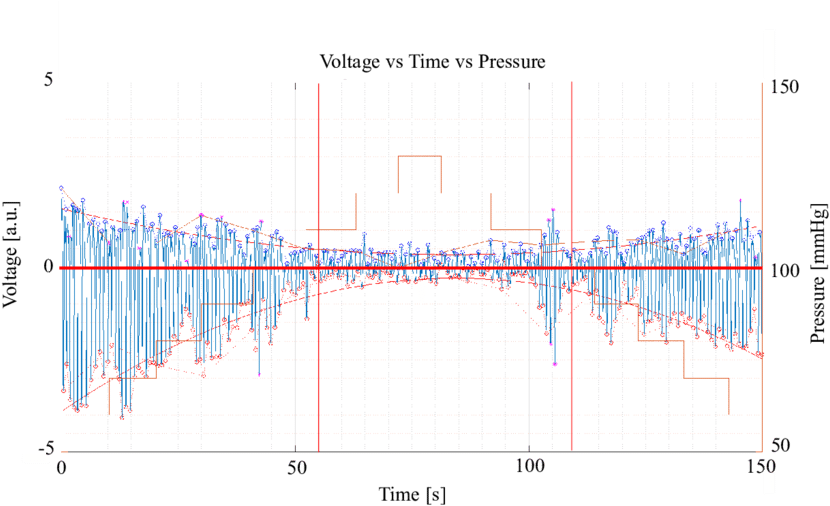 Green Light Processed With Matlab From An Oeps Signal - Diagram (850x516), Png Download