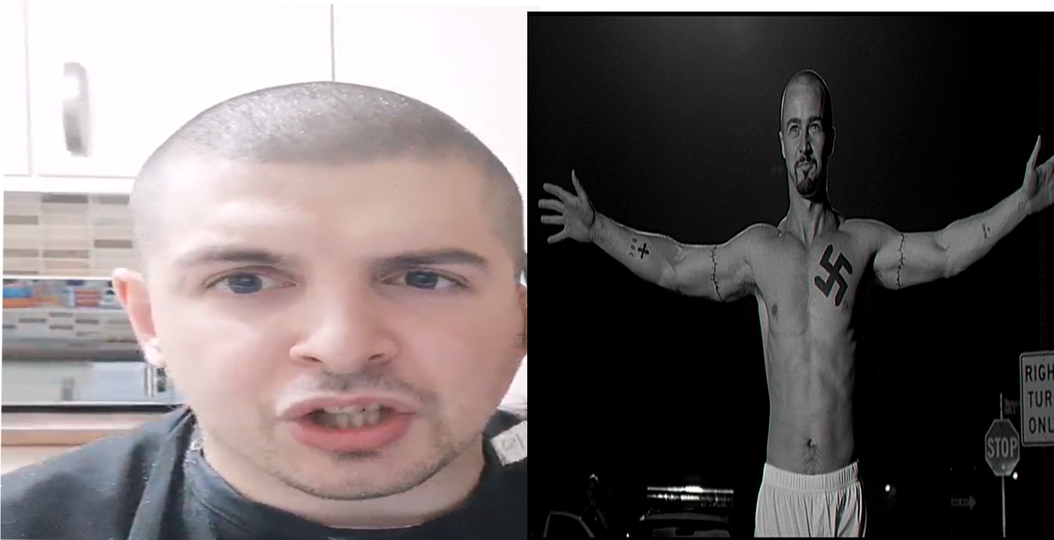 Bald Gore Omegalul - Hair Loss (2100x1500), Png Download
