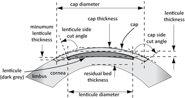 At Present This Requires A Curved Suction Cup Placed - Diagram (601x320), Png Download