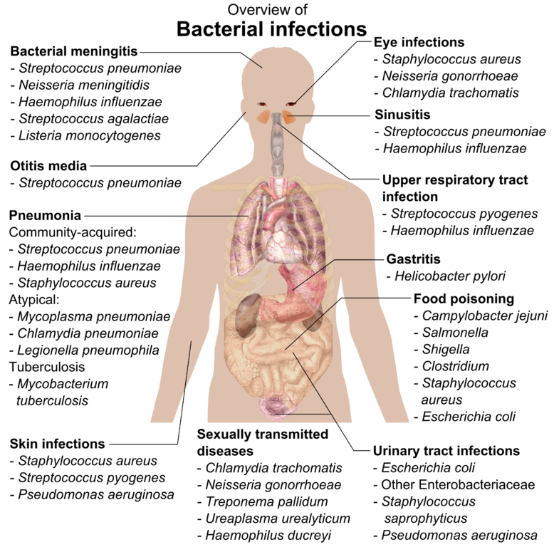 Bacterial Infections And Involved Species - Overview Of Bacterial Infections (778x768), Png Download