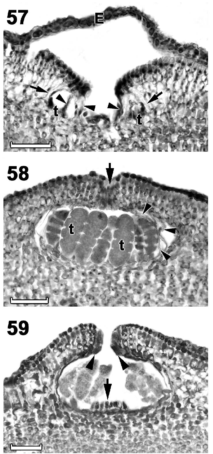 Section Through A Young Tetrasporangial Conceptacle - Cartelas De Bingo Para Imprimir (850x1614), Png Download
