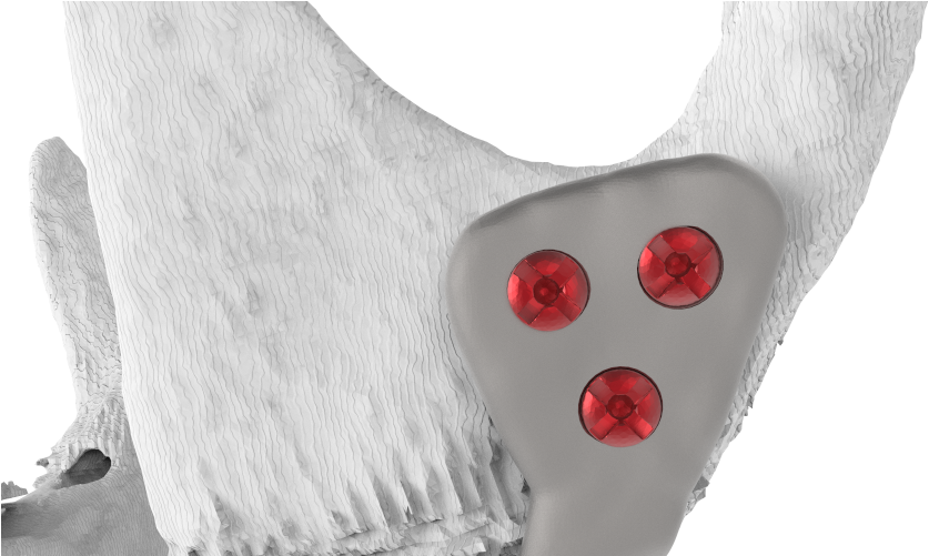 3angle Plate Transparent - Poppy (878x500), Png Download