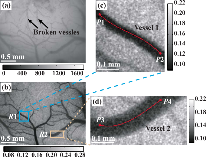 A White Light Image Of The Rat's Left Parietal Lobe - Rat Laser Speckle Contrast Imaging (681x519), Png Download