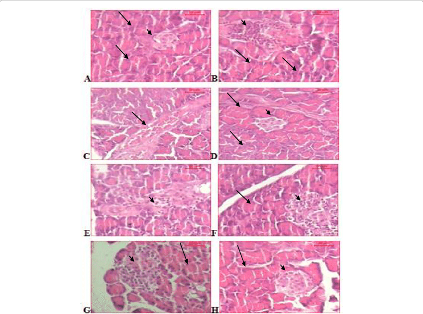 Sections Of Pancreas Of A) Control Rat Shows Dense - Pancreas (850x631), Png Download