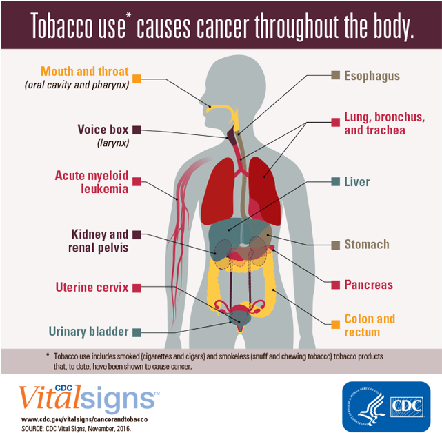 Cancer Caused By Tobacco Consumption (640x640), Png Download