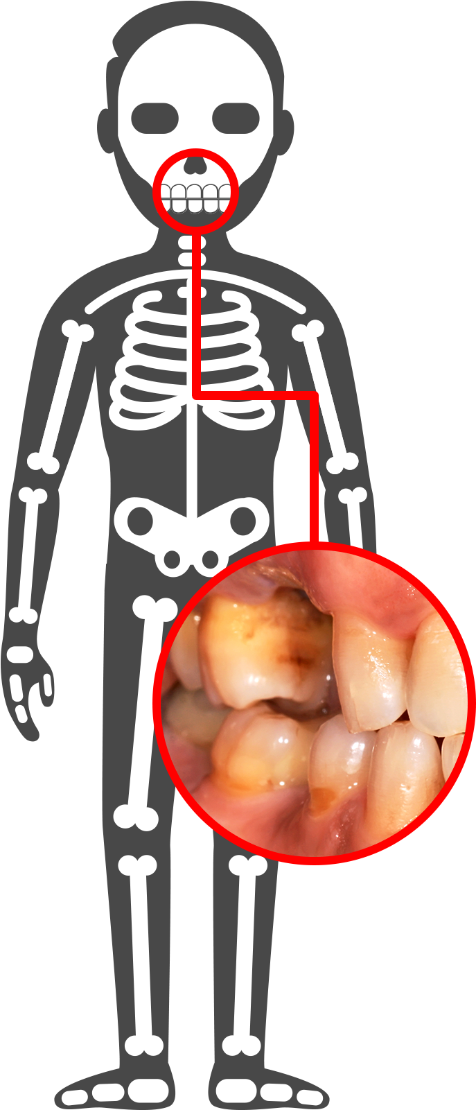 Pancreas - Human Body Illustration Png (1000x1600), Png Download