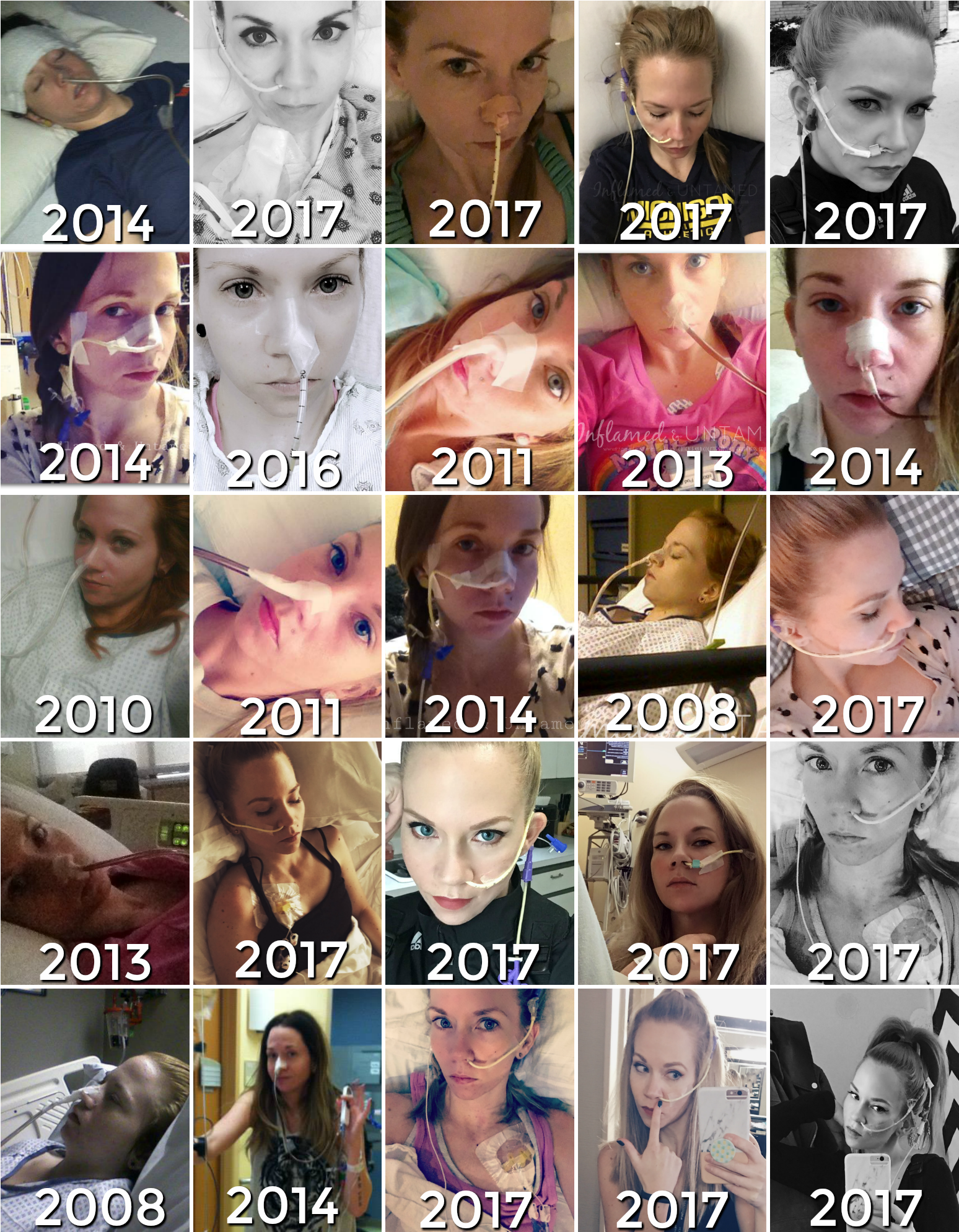 Picture 2 Ng Tube Blog - Blog (1559x2000), Png Download