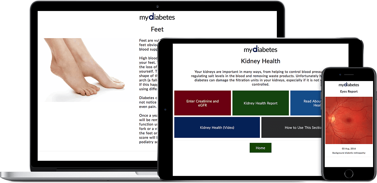 Eyes, Kidney And Foot Care - Copper Compression Arch Support - 2 Plantar Fasciitis (1442x700), Png Download