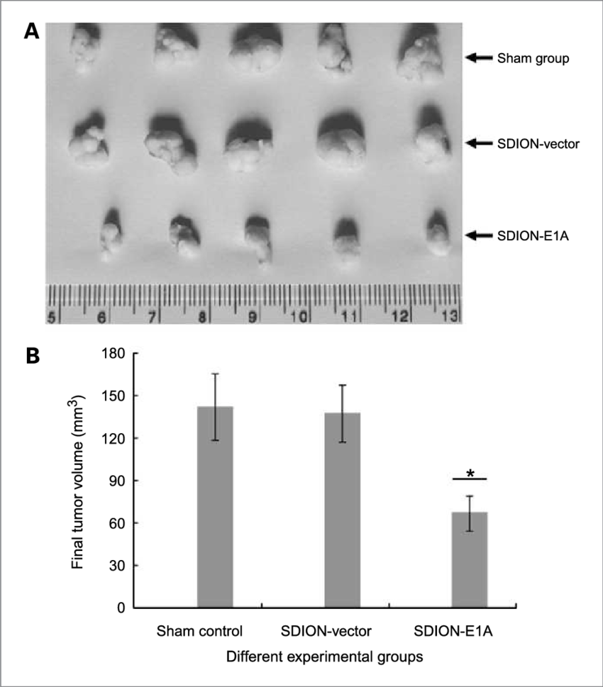 The Final Tumor Volume In Cervical Cancer Xenograft - Cancer (850x969), Png Download
