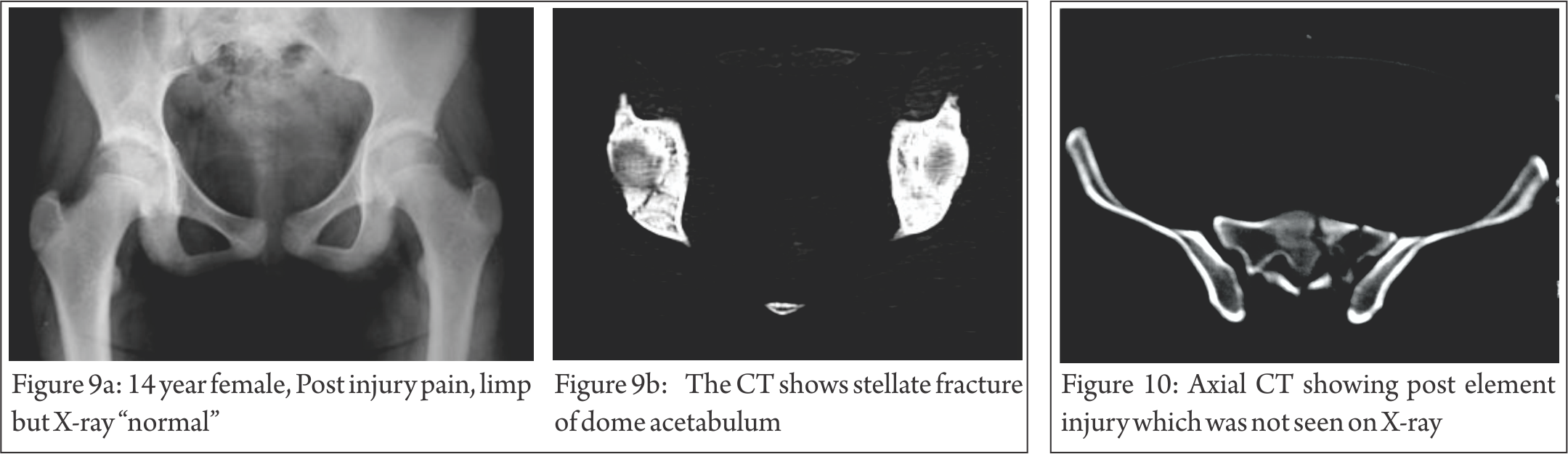 These Images Are Easy To Understand, Easy To Manipulate - Medical Imaging (2159x625), Png Download